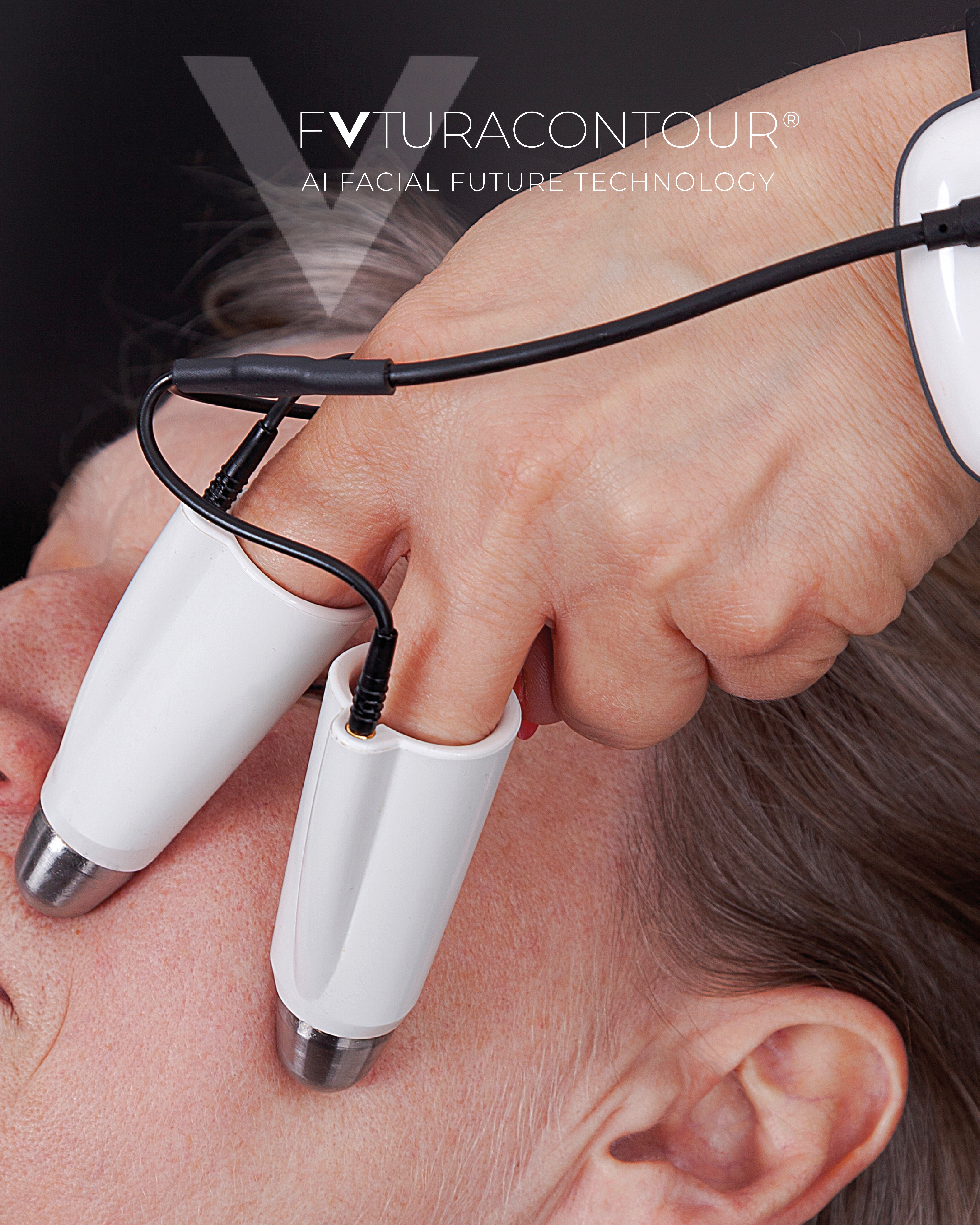 FUTURACONTOUR® – HAUTSTRAFFUNG & KONTOUREN- VERBESSERUNG im Charisma Beautycenter Bad Friedrichshall